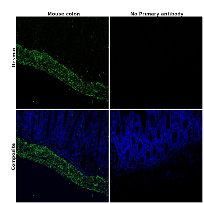 Desmin Antibody in Immunohistochemistry (Paraffin) (IHC (P))