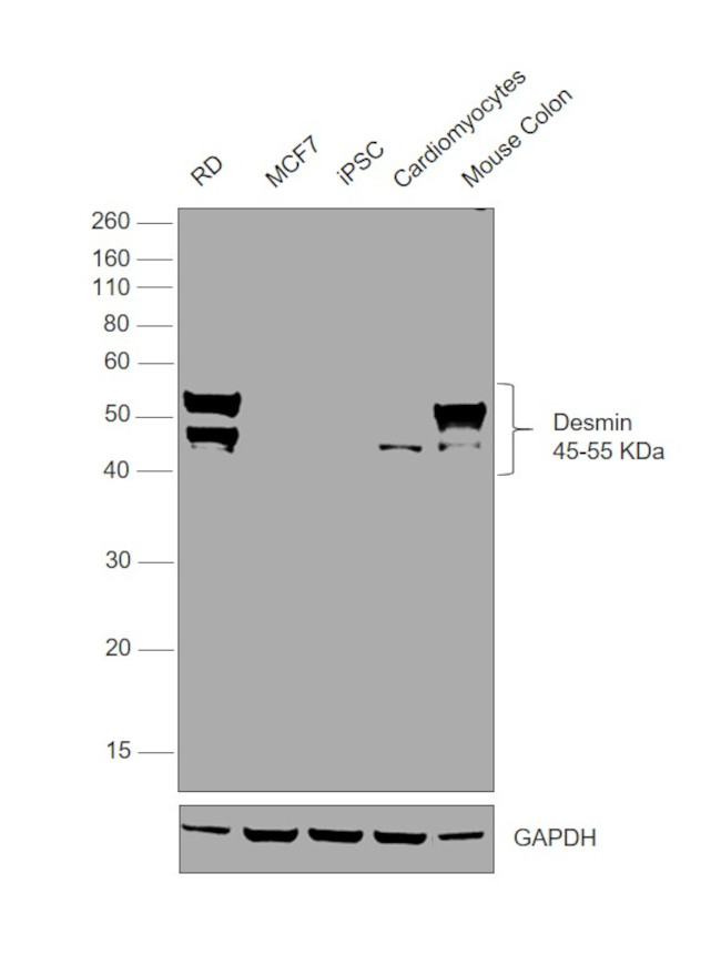 Desmin Antibody in Western Blot (WB)