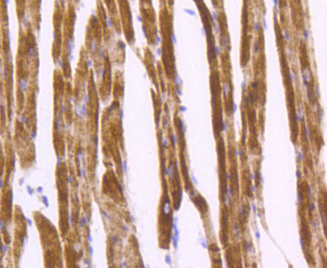 Desmin Antibody in Immunohistochemistry (Paraffin) (IHC (P))