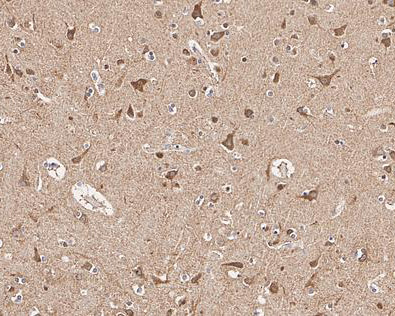 PIK3CA Antibody in Immunohistochemistry (Paraffin) (IHC (P))