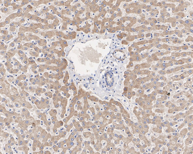 PIK3CA Antibody in Immunohistochemistry (Paraffin) (IHC (P))