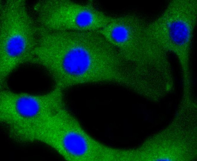 Calmodulin Antibody in Immunocytochemistry (ICC/IF)