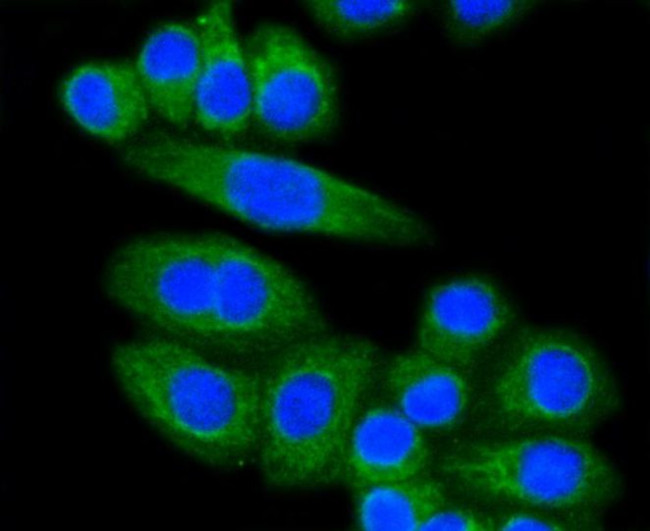 LDLR Antibody in Immunocytochemistry (ICC/IF)