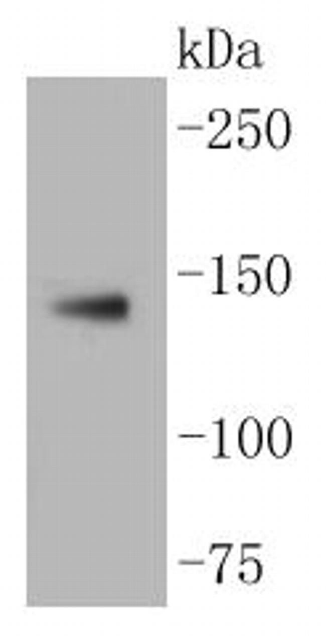 LDLR Antibody in Western Blot (WB)