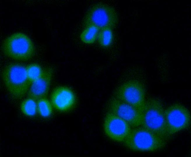 MMP14 Antibody in Immunocytochemistry (ICC/IF)