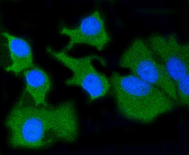 MMP14 Antibody in Immunocytochemistry (ICC/IF)