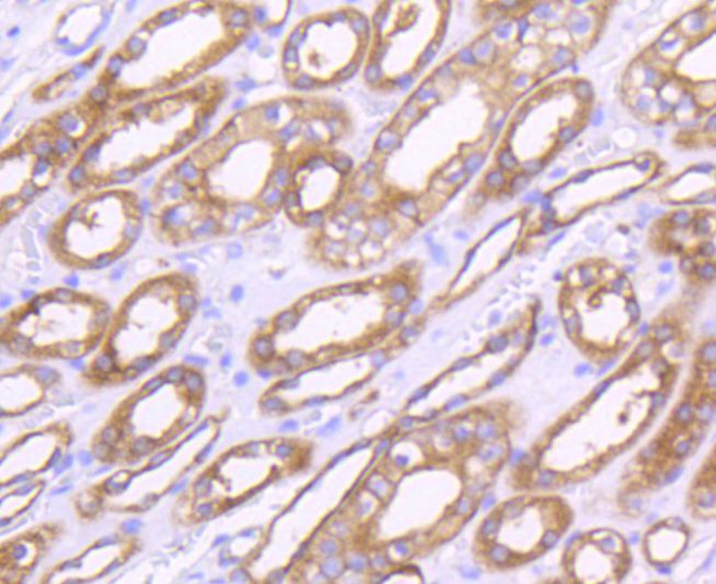 MMP14 Antibody in Immunohistochemistry (Paraffin) (IHC (P))