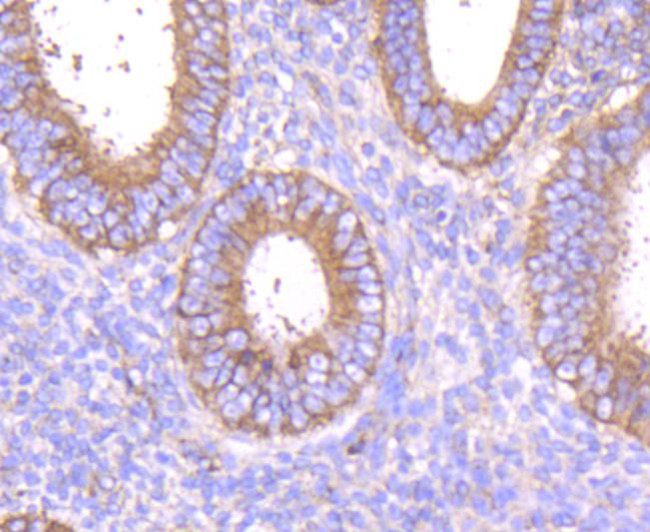 MMP14 Antibody in Immunohistochemistry (Paraffin) (IHC (P))