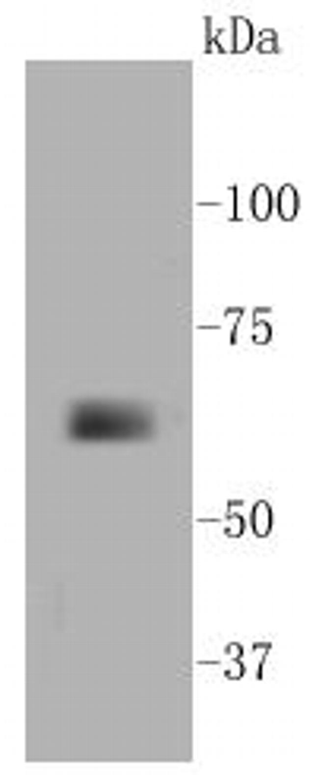 MMP14 Antibody in Western Blot (WB)