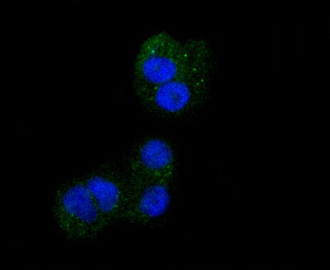 CD61 (Integrin beta 3) Antibody in Immunocytochemistry (ICC/IF)