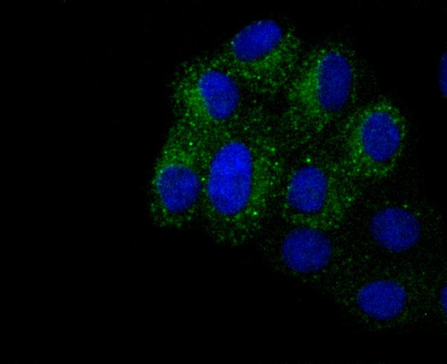 CD61 (Integrin beta 3) Antibody in Immunocytochemistry (ICC/IF)