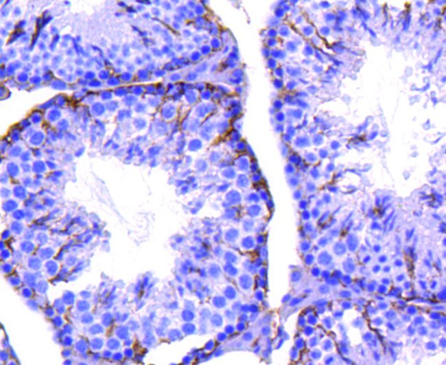 CD61 (Integrin beta 3) Antibody in Immunohistochemistry (Paraffin) (IHC (P))