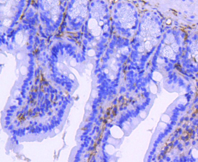 CD61 (Integrin beta 3) Antibody in Immunohistochemistry (Paraffin) (IHC (P))