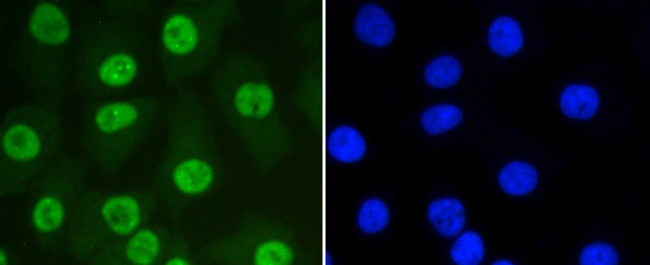 SUMO1 Antibody in Immunocytochemistry (ICC/IF)