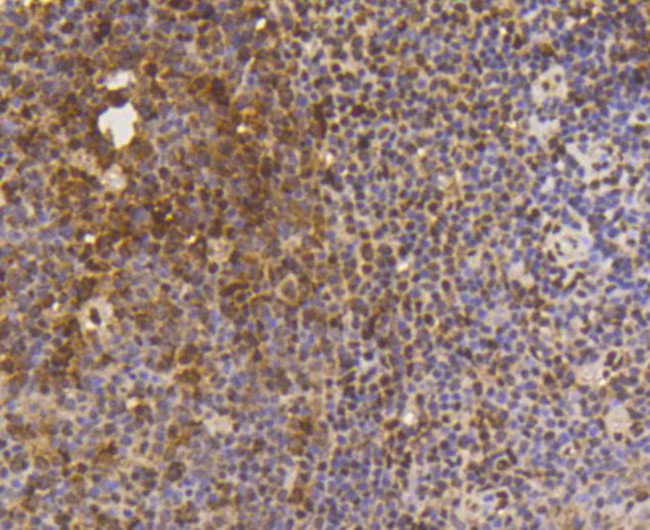 SUMO1 Antibody in Immunohistochemistry (Paraffin) (IHC (P))