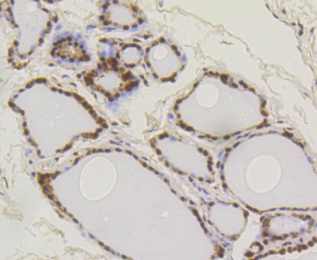 SUMO1 Antibody in Immunohistochemistry (Paraffin) (IHC (P))