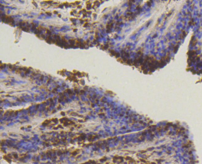 SUMO1 Antibody in Immunohistochemistry (Paraffin) (IHC (P))