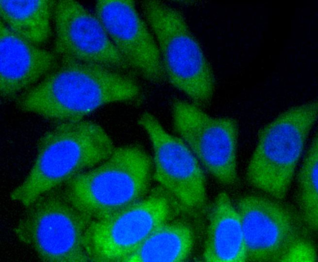 NOTCH1 Antibody in Immunocytochemistry (ICC/IF)