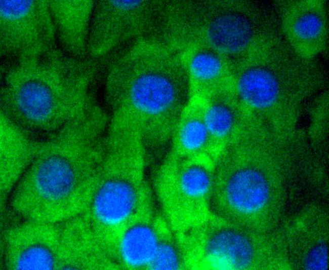 NOTCH1 Antibody in Immunocytochemistry (ICC/IF)