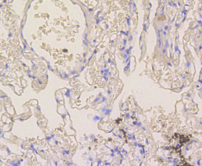 NOTCH1 Antibody in Immunohistochemistry (Paraffin) (IHC (P))