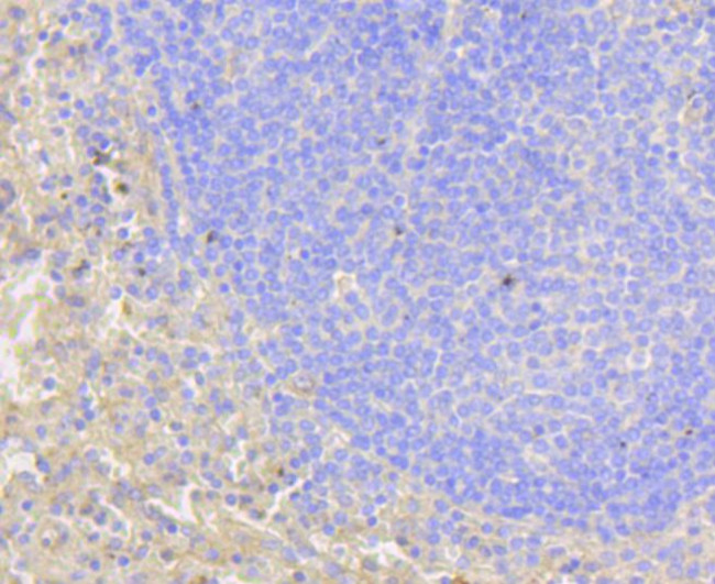 NOTCH1 Antibody in Immunohistochemistry (Paraffin) (IHC (P))