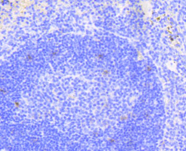 NOTCH1 Antibody in Immunohistochemistry (Paraffin) (IHC (P))