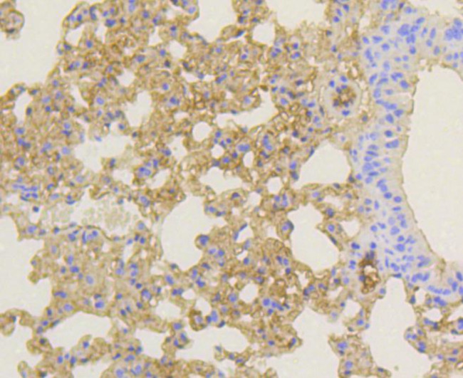 NOTCH1 Antibody in Immunohistochemistry (Paraffin) (IHC (P))