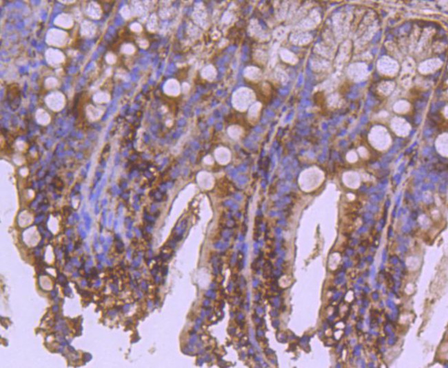 APAF1 Antibody in Immunohistochemistry (Paraffin) (IHC (P))