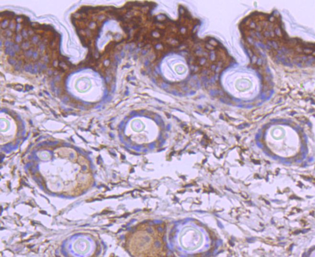 APAF1 Antibody in Immunohistochemistry (Paraffin) (IHC (P))