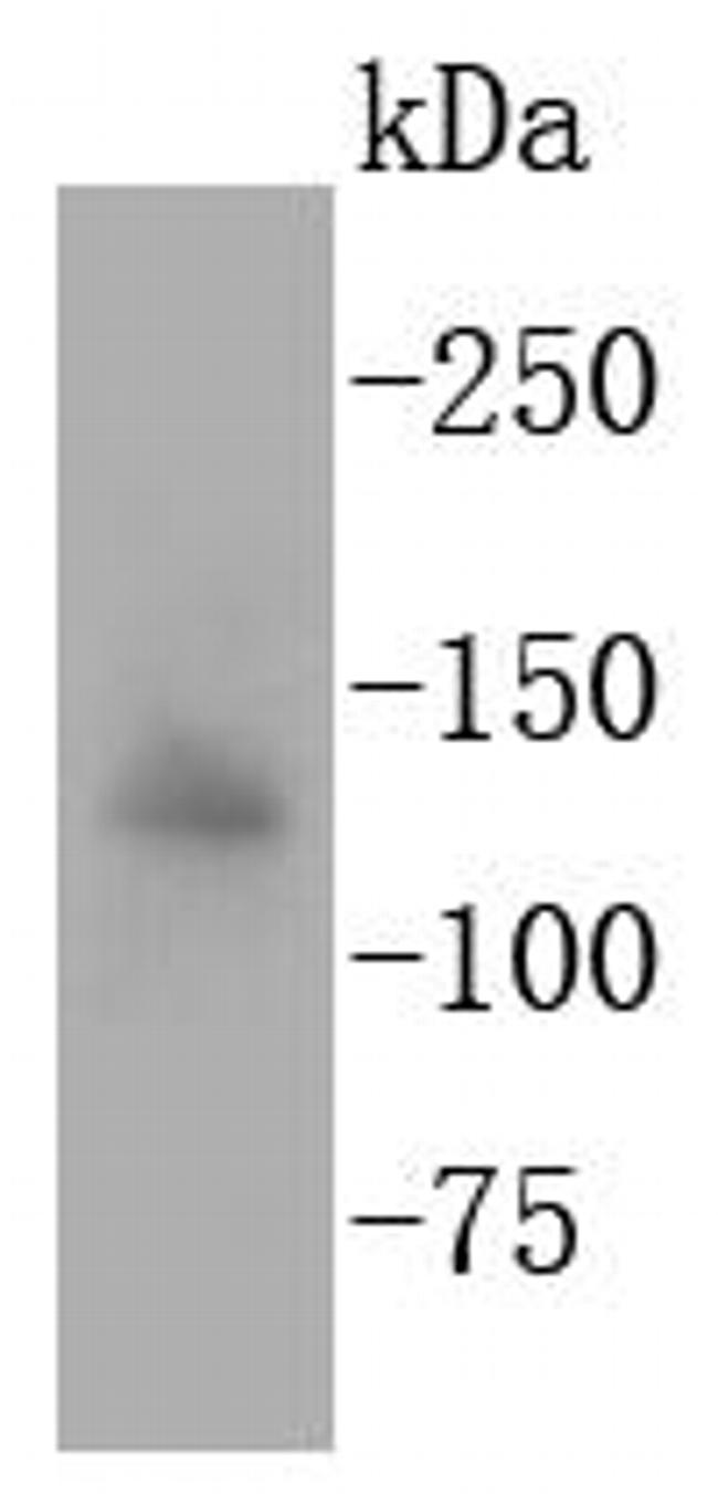 APAF1 Antibody in Western Blot (WB)