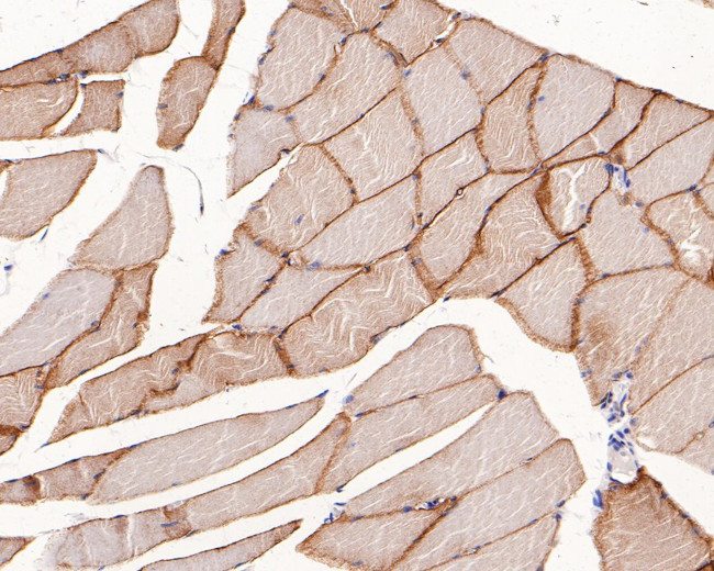 Caveolin 3 Antibody in Immunohistochemistry (Paraffin) (IHC (P))