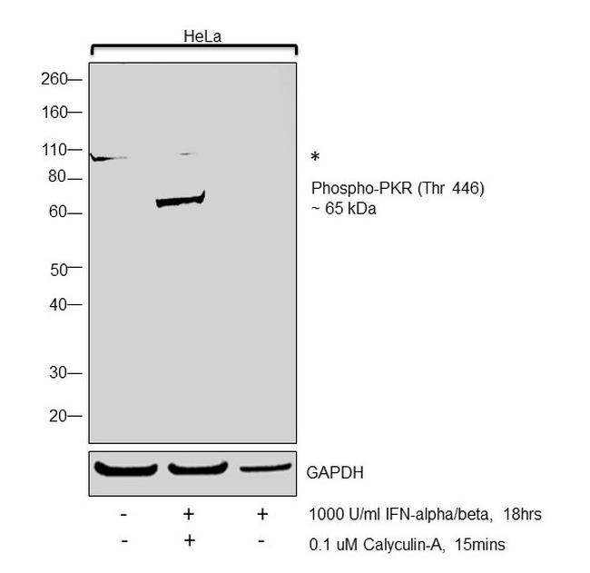 Phospho-PKR (Thr446) Antibody in Western Blot (WB)