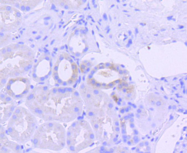 Phospho-PKR (Thr446) Antibody in Immunohistochemistry (Paraffin) (IHC (P))