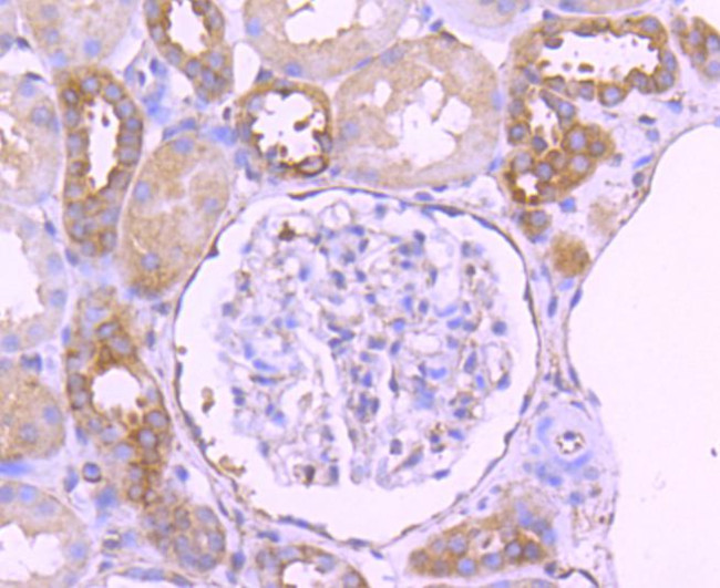 Paxillin Antibody in Immunohistochemistry (Paraffin) (IHC (P))