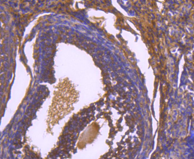 Paxillin Antibody in Immunohistochemistry (Paraffin) (IHC (P))