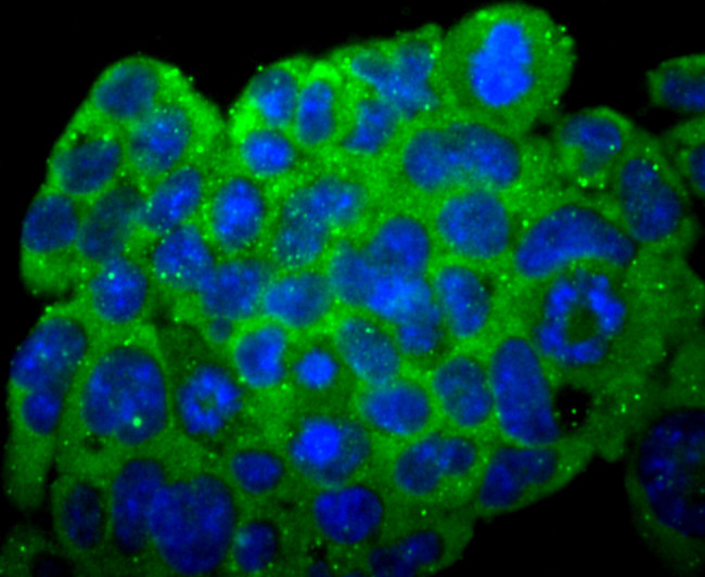 N-cadherin Antibody in Immunocytochemistry (ICC/IF)