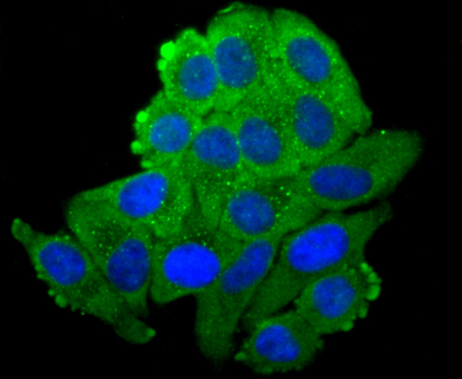 N-cadherin Antibody in Immunocytochemistry (ICC/IF)