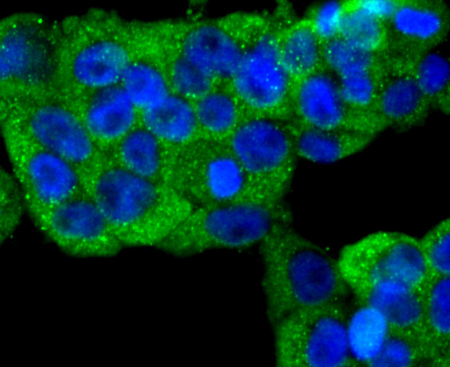 N-cadherin Antibody in Immunocytochemistry (ICC/IF)