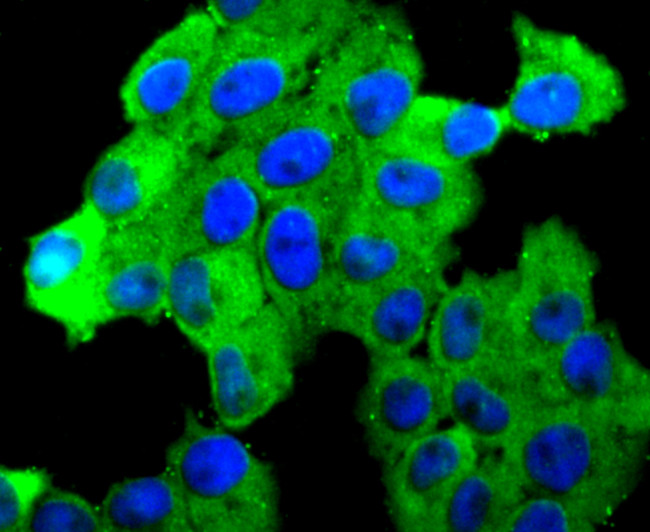 N-cadherin Antibody in Immunocytochemistry (ICC/IF)