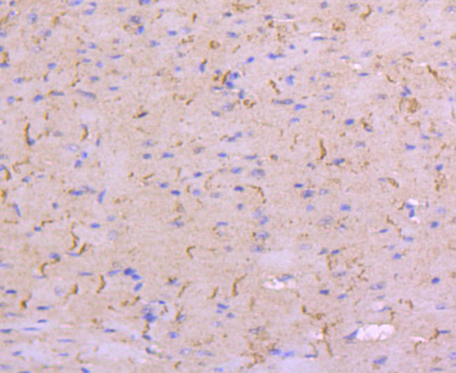 N-cadherin Antibody in Immunohistochemistry (Paraffin) (IHC (P))