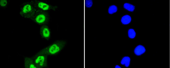 Phospho-STAT3 (Ser727) Antibody in Immunocytochemistry (ICC/IF)