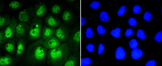 Phospho-STAT3 (Ser727) Antibody in Immunocytochemistry (ICC/IF)