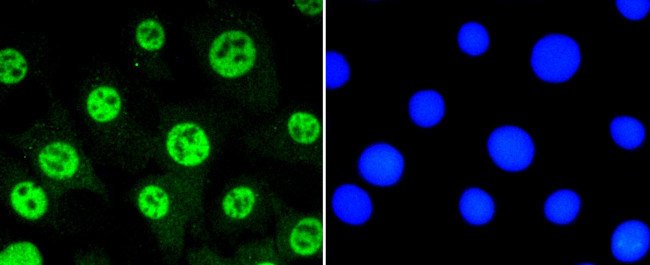 Phospho-STAT3 (Ser727) Antibody in Immunocytochemistry (ICC/IF)