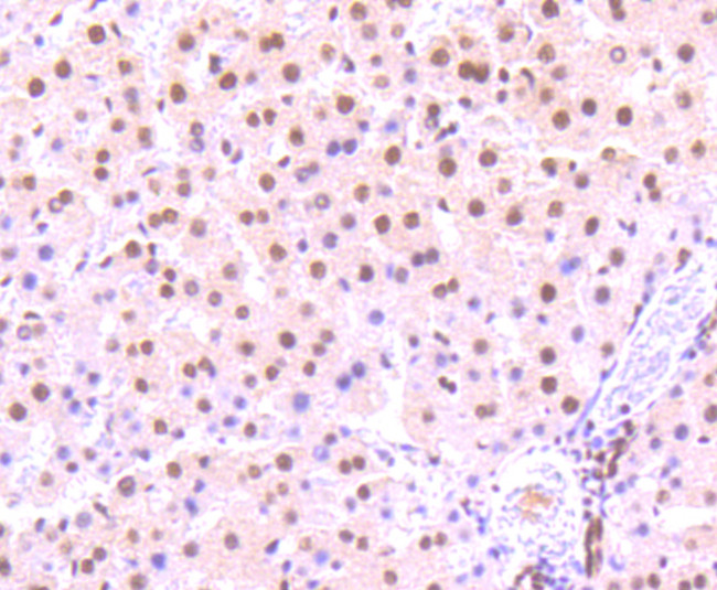 Phospho-STAT3 (Ser727) Antibody in Immunohistochemistry (Paraffin) (IHC (P))