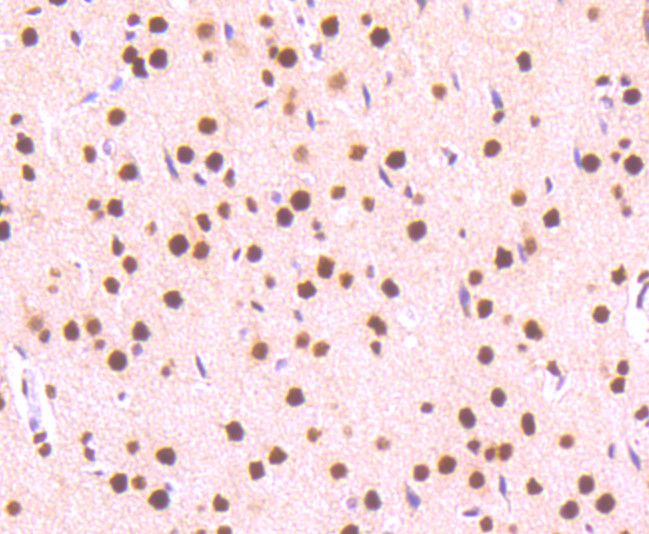 Phospho-STAT3 (Ser727) Antibody in Immunohistochemistry (Paraffin) (IHC (P))