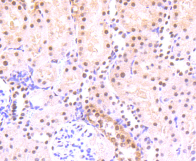 Phospho-STAT3 (Ser727) Antibody in Immunohistochemistry (Paraffin) (IHC (P))