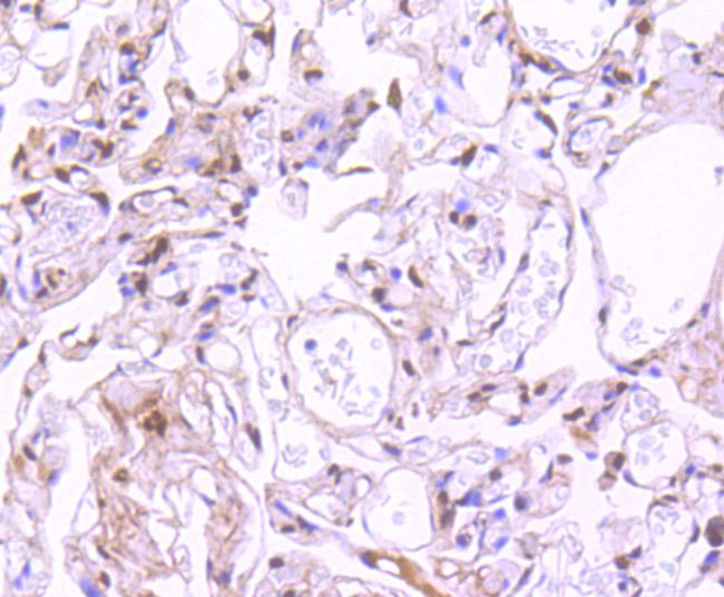 Phospho-STAT3 (Ser727) Antibody in Immunohistochemistry (Paraffin) (IHC (P))