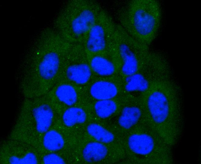 NOX4 Antibody in Immunocytochemistry (ICC/IF)