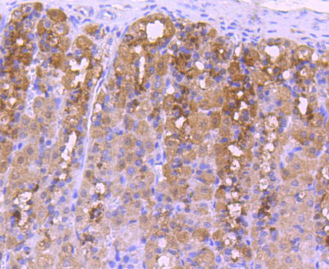 NOX4 Antibody in Immunohistochemistry (Paraffin) (IHC (P))