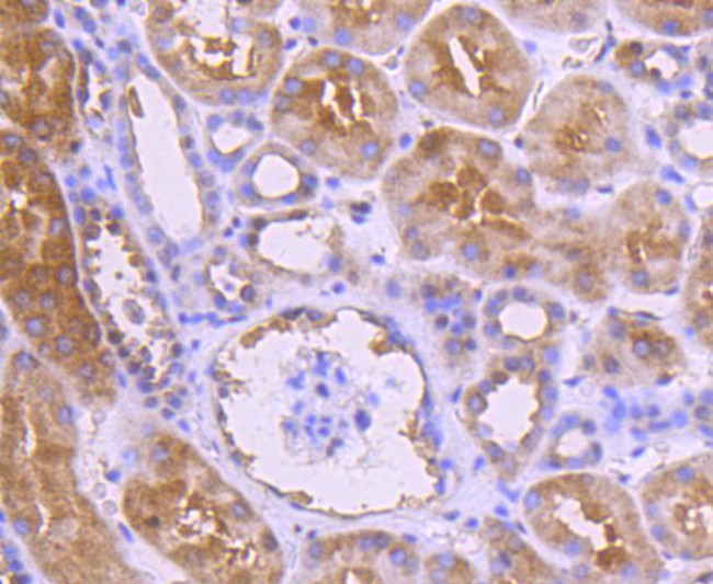 NOX4 Antibody in Immunohistochemistry (Paraffin) (IHC (P))